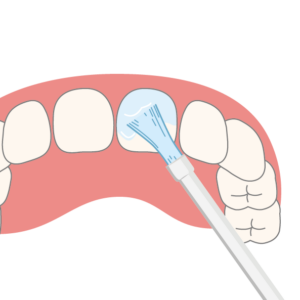 zahn-kind_fluoridierung-24