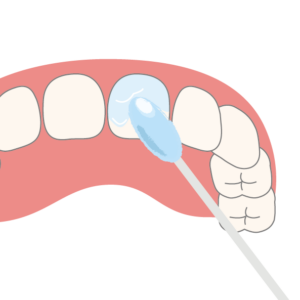 zahn-kind_fluoridierung-25